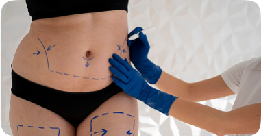 Пластична хірургія: міфи та реальність. Що варто знати перед операцією?